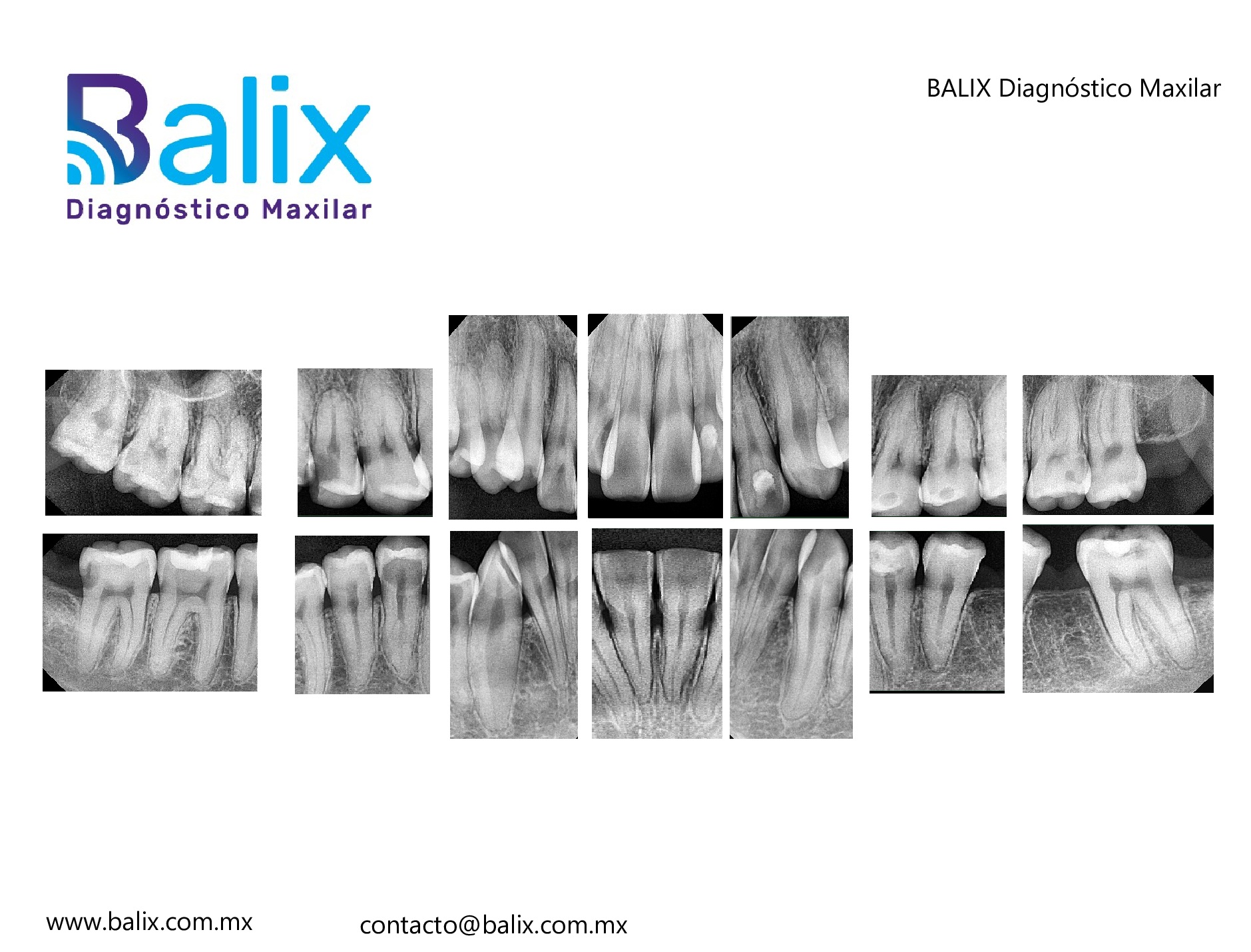 Serie Periapical